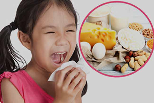 बच्चाें में फूड एलर्जी (Food Allergy in Children)