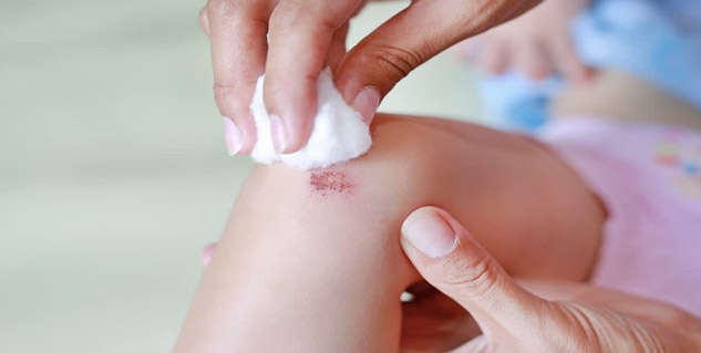 wound-care-at-home-inside1