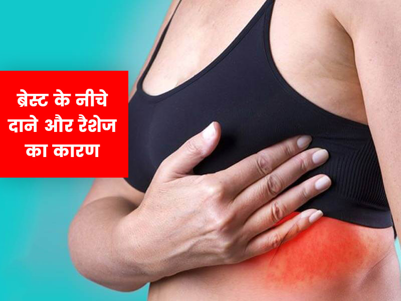 ब्रेस्ट के नीचे या आस-पास क्यों होते हैं दाने और रैशेज? जानें इसके 7 कारण और कुछ घरेलू उपचार