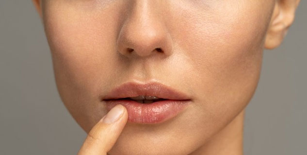 chapped lips
