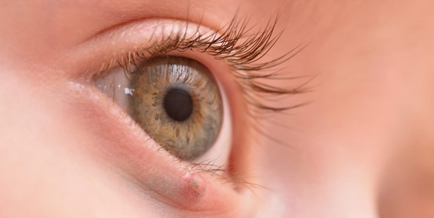 Orbital-Tumors-Causes-Symptoms-Treatment