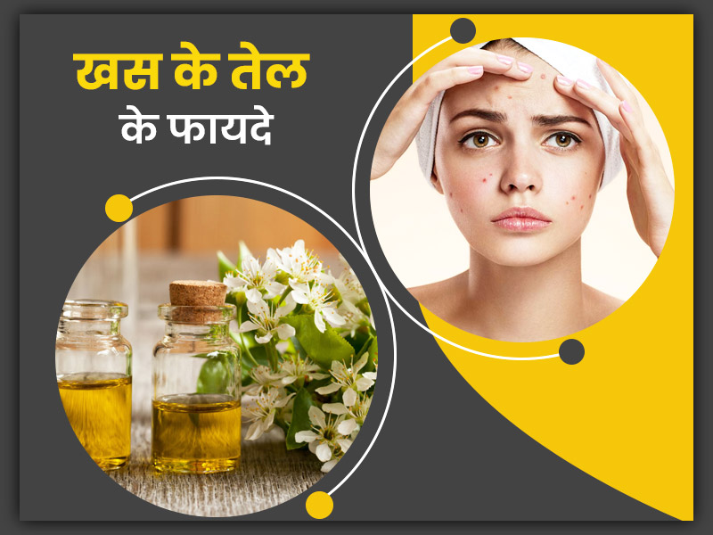 कील मुंहासे के दाग धब्बे दूर करता है खस का तेल, जानें त्वचा के लिए इसके 5 फायदे