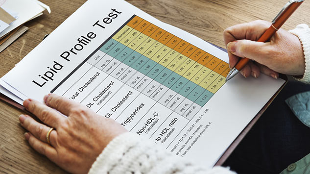 Lipid Profile Test