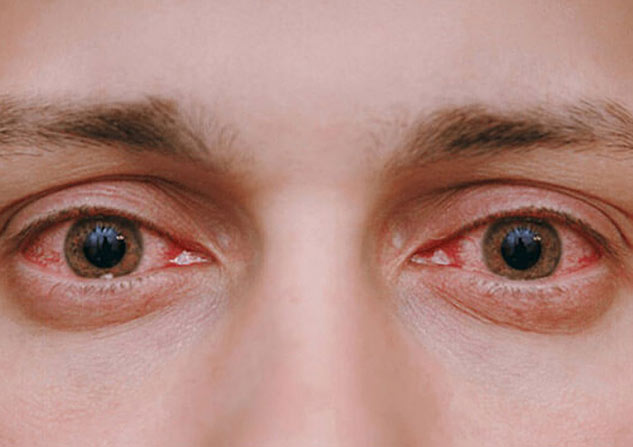 inside1omega-3deficiencysymptoms