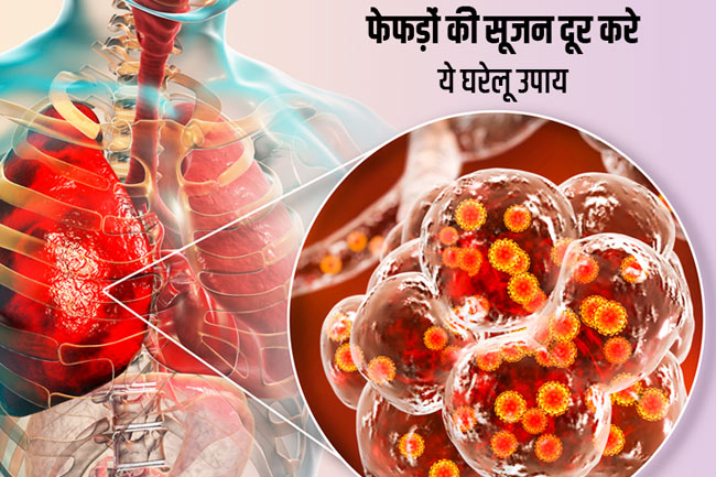 फेफड़ाें में सूजन (Lung Inflammation)