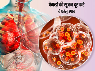 फेफड़ाें में सूजन के लक्षण और इससे छुटकारा पाने के लिए 8 घरेलू उपाय