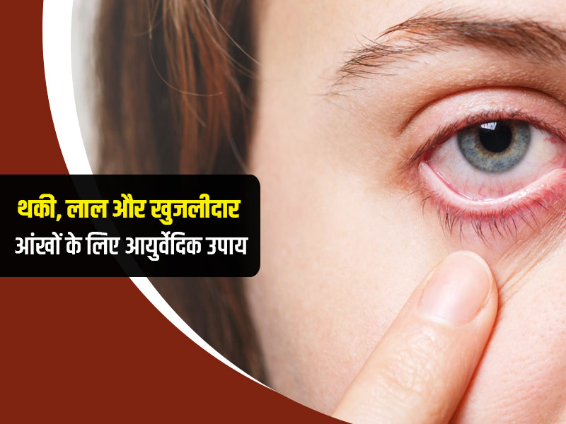 थकी, लाल और खुजलीदार आंखों से छुटकारा चाहते हैं तो ट्राई करें ये आयुर्वेदिक नुस्खा, मिलेगी राहत