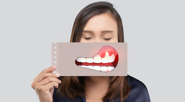 Gum-Cancer-in-Hindi