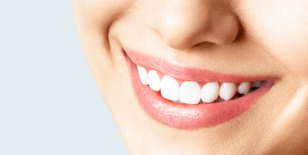 teeth-whitening