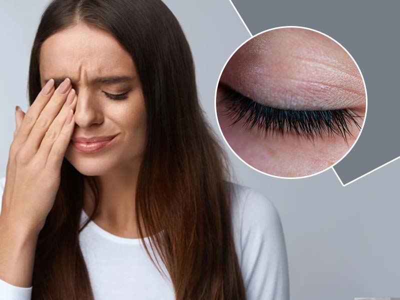 पलकों में खुजली हो सकती है Ocular Pruritus रोग का संकेत, जानें इसका कारण और इलाज