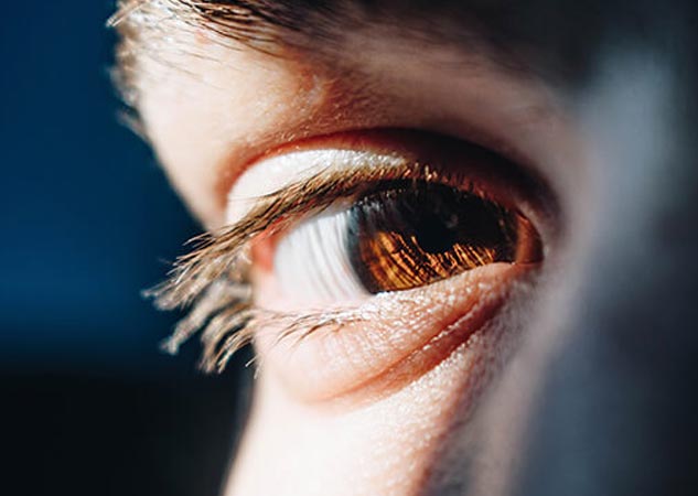 Ocular-Pruritus-in-Hindi