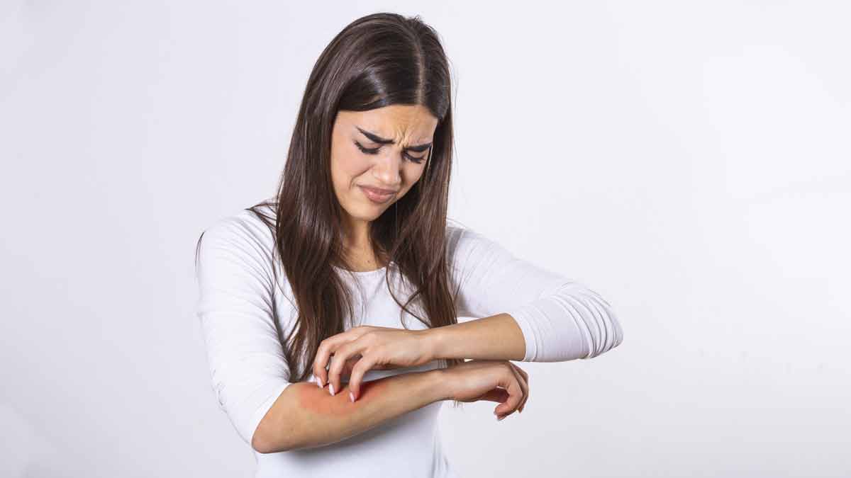 Home Remedies To Get Rid Of Skin Allergies