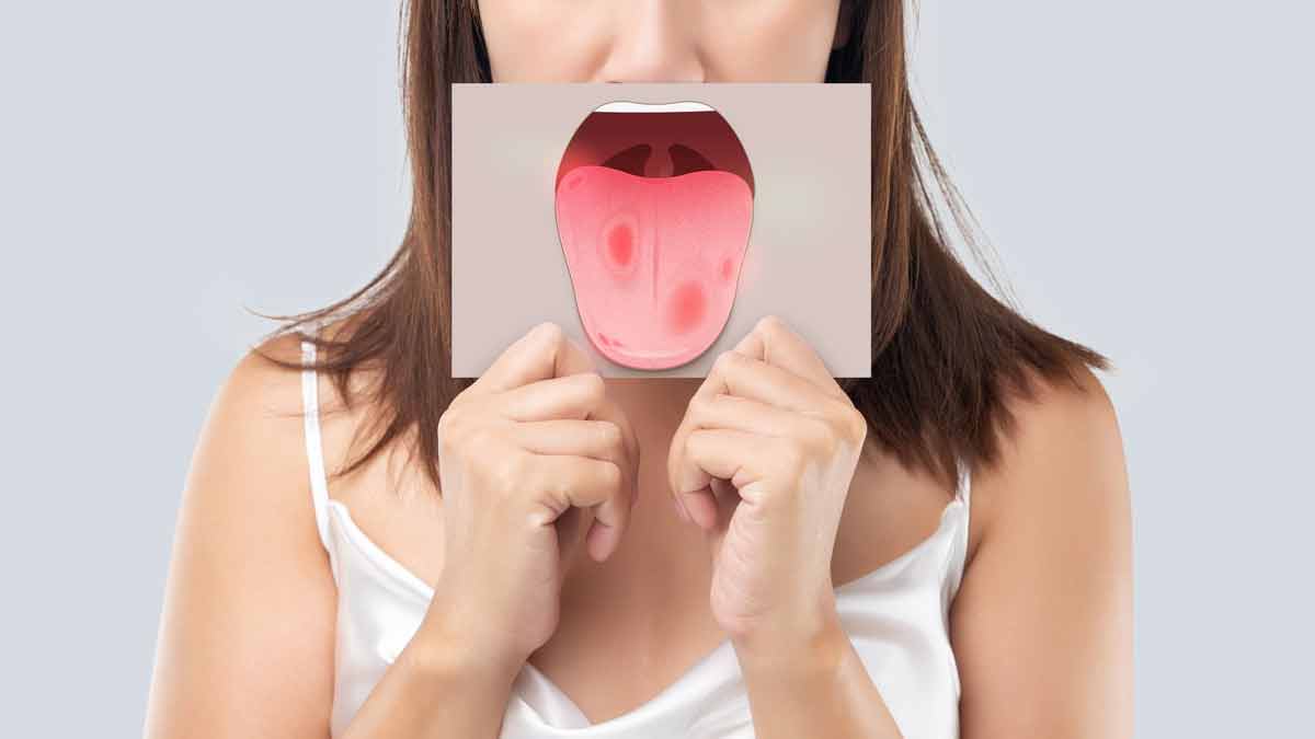 Itchy tongue causes home remedies