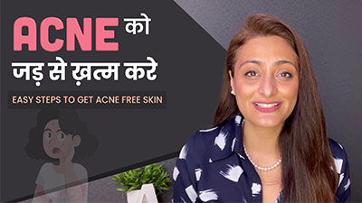 Easy steps to get Acne free skin