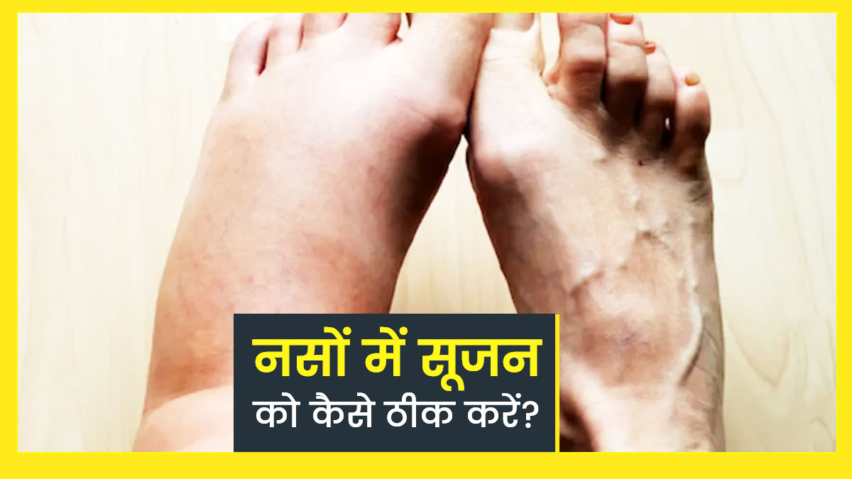 नसों की सूजन कम करने के लिए अजमाएं ये 4 उपाय, दर्द से मिलेगी राहत