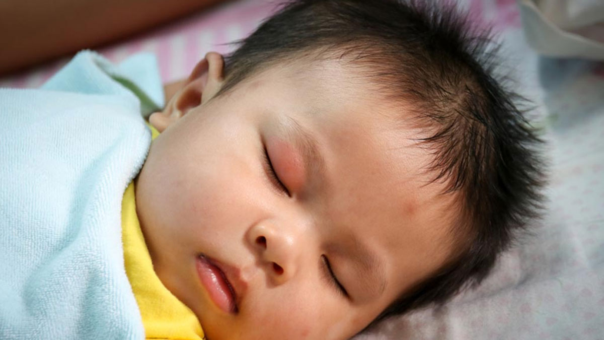 सर्दियों में आ गई शिशु की आंख में सूजन? जानें कारण और उपाय