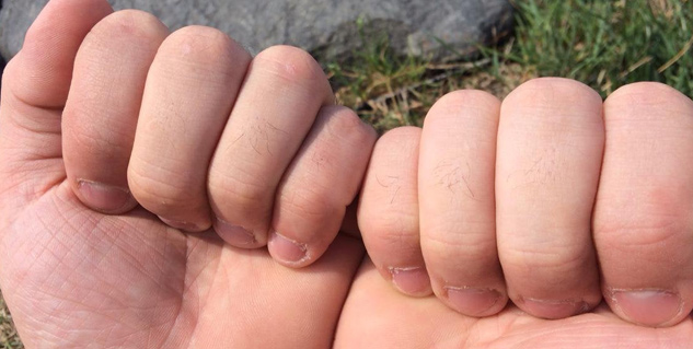 hair on fingers