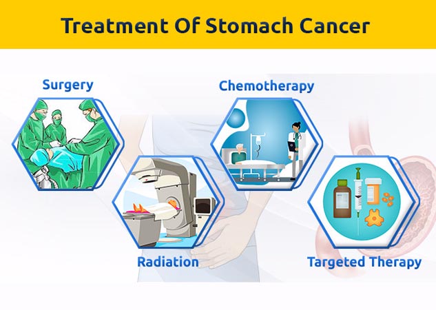 tumor treatment