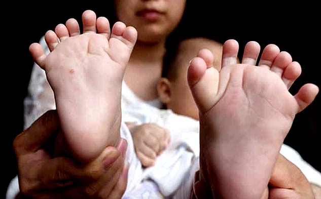 insidePolydactylyinkids