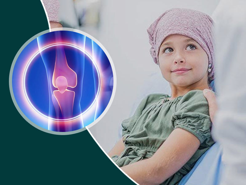 बच्चों में हड्डियों का कैंसर (Bone Cancer) क्यों होता है? जानें इसके लक्षण, कारण और इलाज