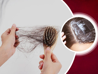 Read These Side effects of Hair Dyeing or Hair Colouring Before Getting It Done