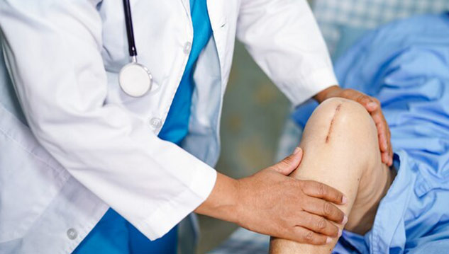 Knee-Replacement-Surgery