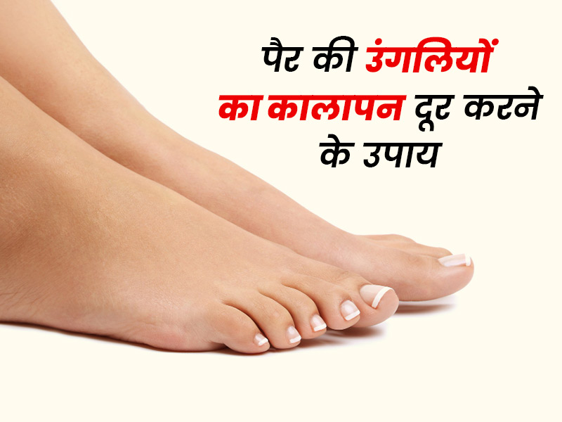 पैर की उंगलियों का कालापन दूर करने के 6 आसान घरेलू तरीके, नाखूनों में भी आएगी चमक