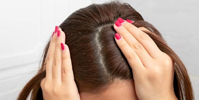 dandruff treatment