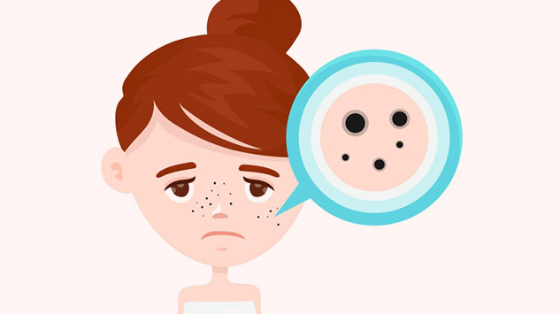 inside1darkspotspimples