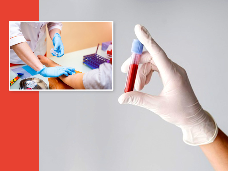 Read These Unique Advantages Of Testing At Home Services