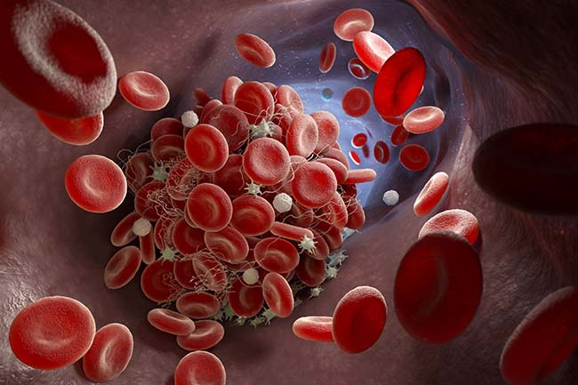 4. ब्लड क्लोटिंग में फायदेमंद (blood cloting)