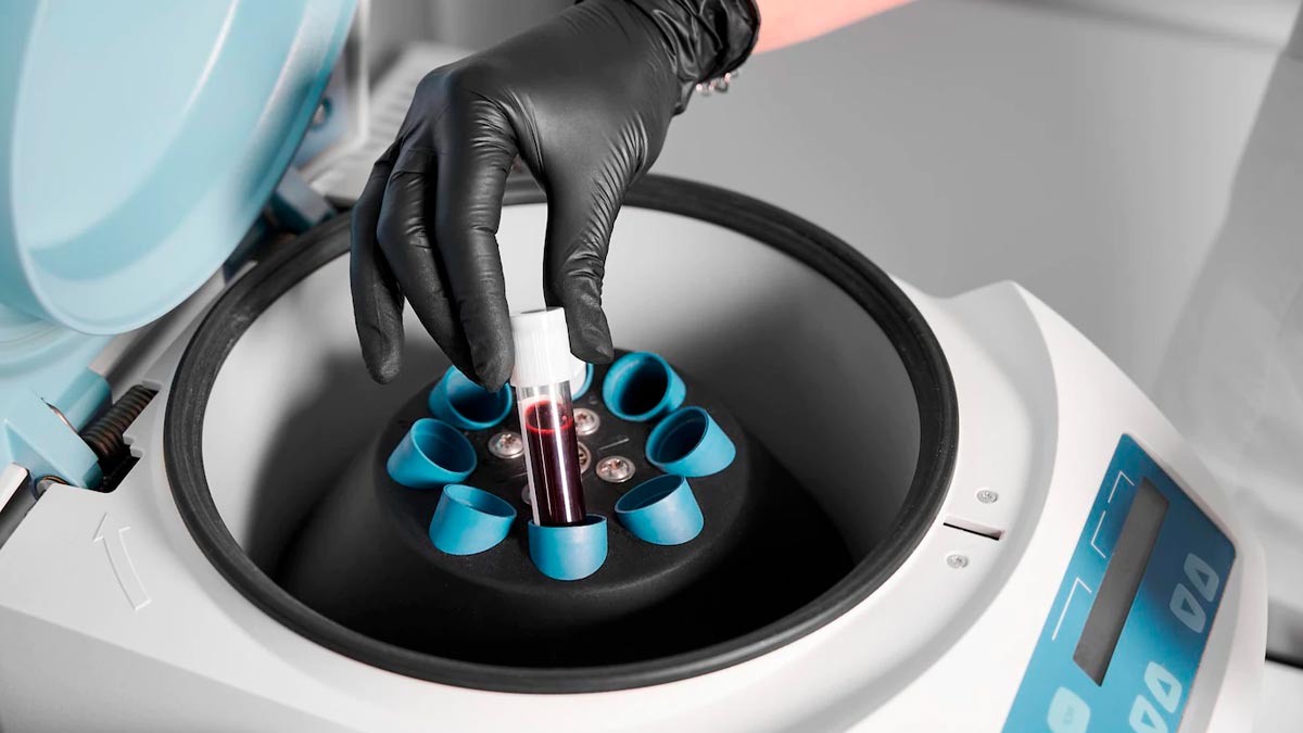 Plasma Therapy Uses