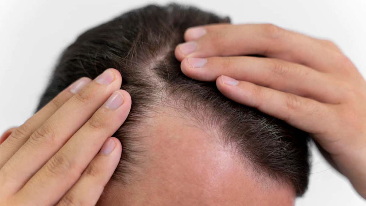 grey hair