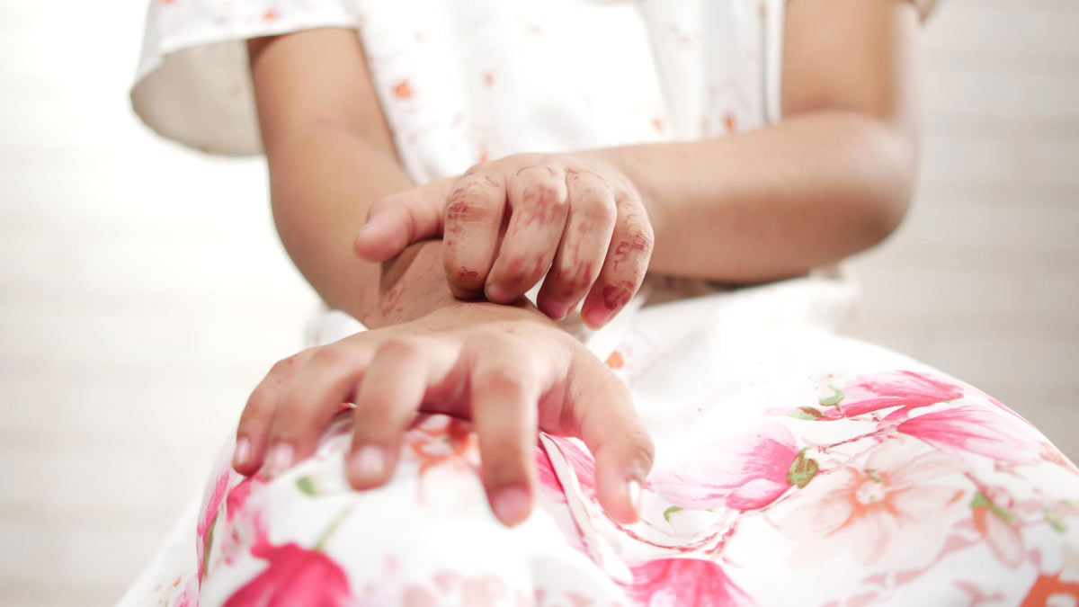 skin allergies in toddlers