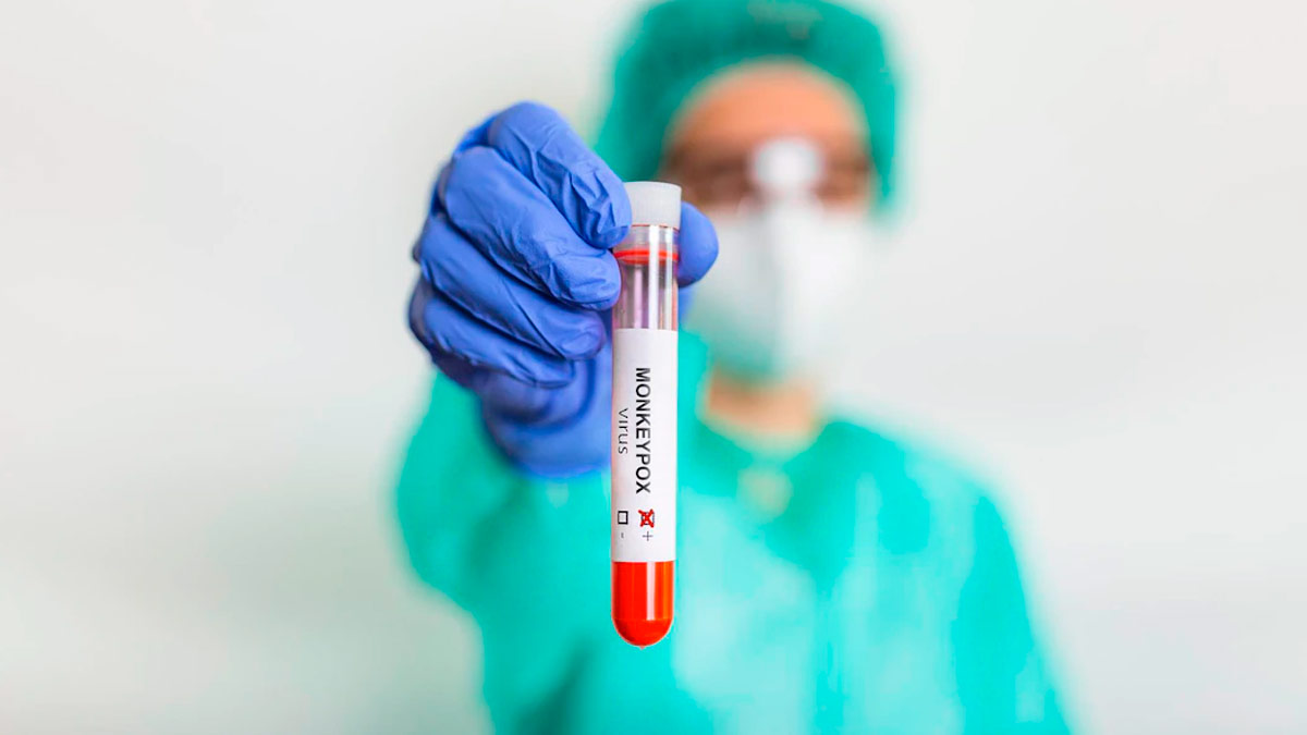 monkeypox declared as pandemic by wnn