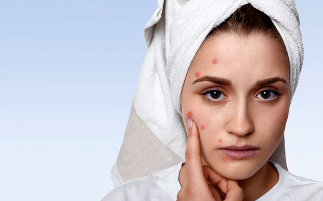 Acne-And-Pimple-Marks