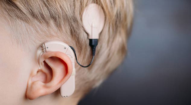 Cochlear-Implant-Surgery