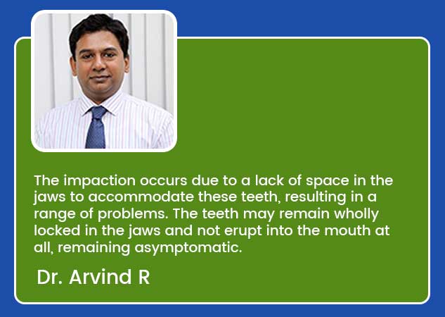 impacted wisdom tooth