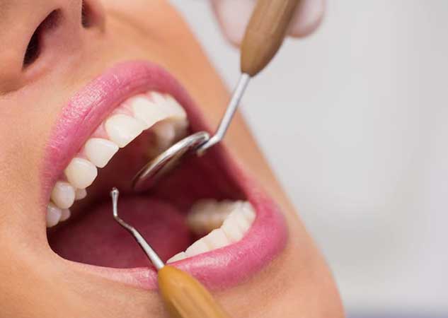 impacted wisdom tooth