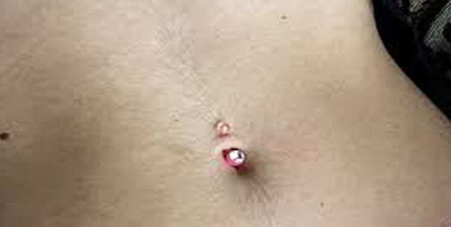 Excessive-hair-causes-