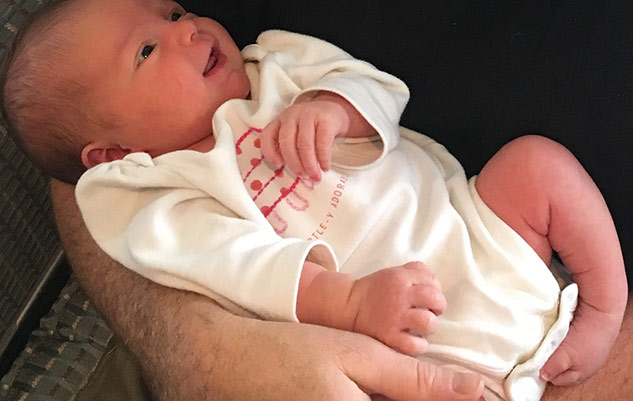 clubfoot leg symptoms