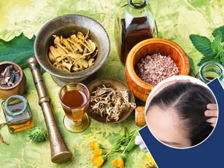 No More Hair Thinning, Bring These Herbs To Your Rescue