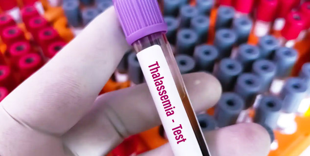 Thalassemia-Types-in-Hindi