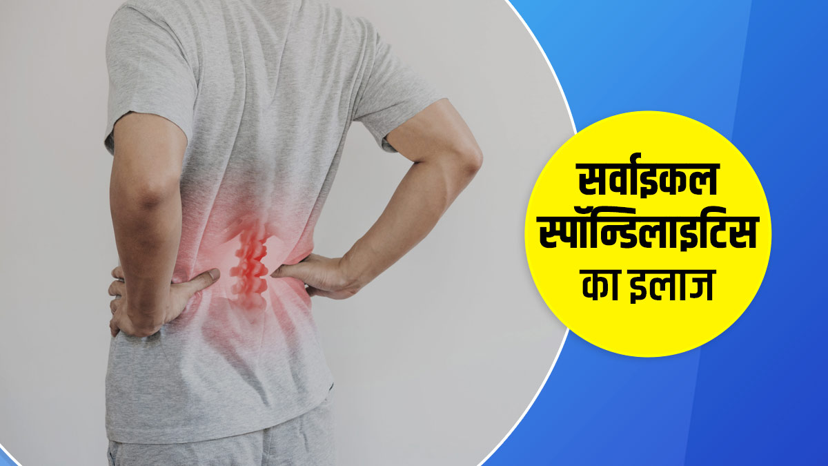 सर्वाइकल स्पोंडिलोसिस क्या है? जानें इसके लक्षण, इलाज और व्यायाम