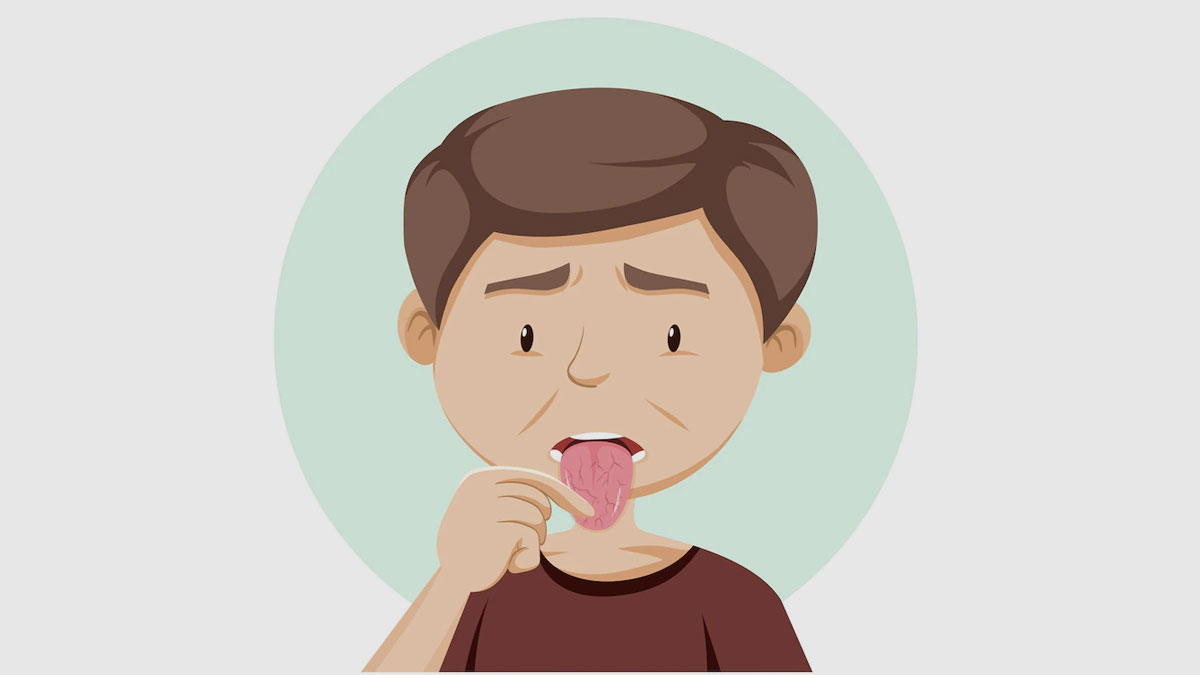 dry mouth in morning