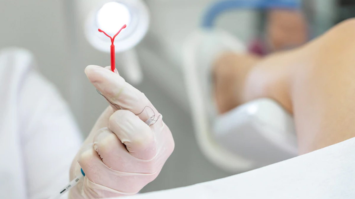 intrauterine device