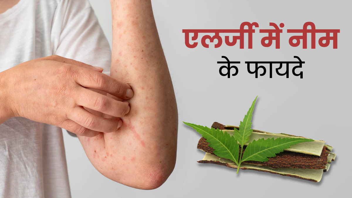 स्किन एलर्जी से छुटकारा दिलाएगा नीम, जानें कैसे करें प्रयोग