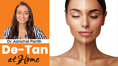 Sun-Tan को हटाएं, इन  Precautions & Remedies को अपनाये। Dr. Aanchal
