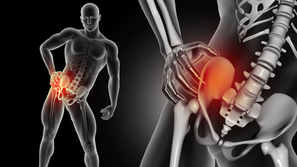 Hip replacement surgery