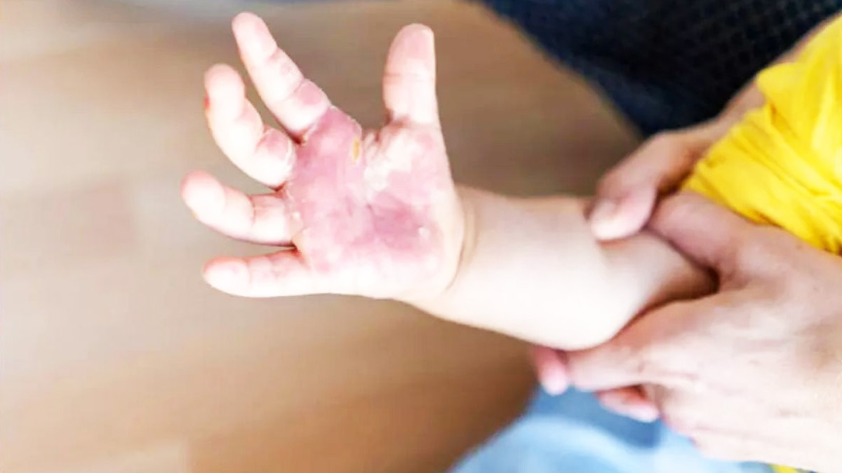 Top-5-Deadly-Diseases-2022